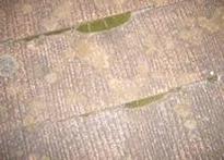 �����̒�����̃R�P